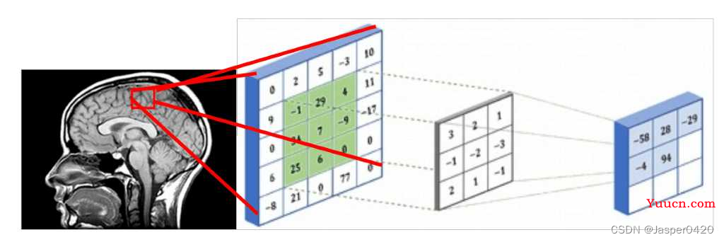 深度学习实战（十）：使用 PyTorch 进行 3D 医学图像分割