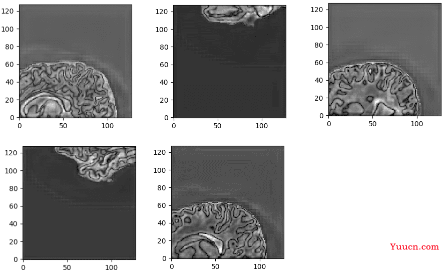 深度学习实战（十）：使用 PyTorch 进行 3D 医学图像分割