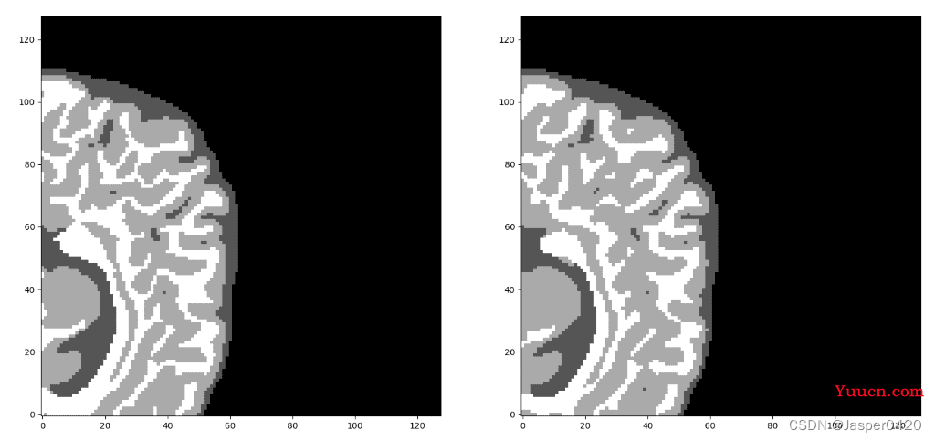 深度学习实战（十）：使用 PyTorch 进行 3D 医学图像分割