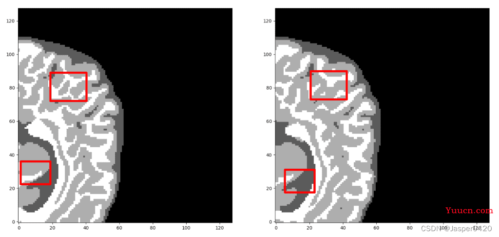 深度学习实战（十）：使用 PyTorch 进行 3D 医学图像分割